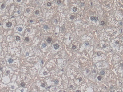 Monoclonal Antibody to Vascular Endothelial Growth Factor 121 (VEGF121)