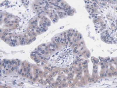 Monoclonal Antibody to Vascular Endothelial Growth Factor 121 (VEGF121)