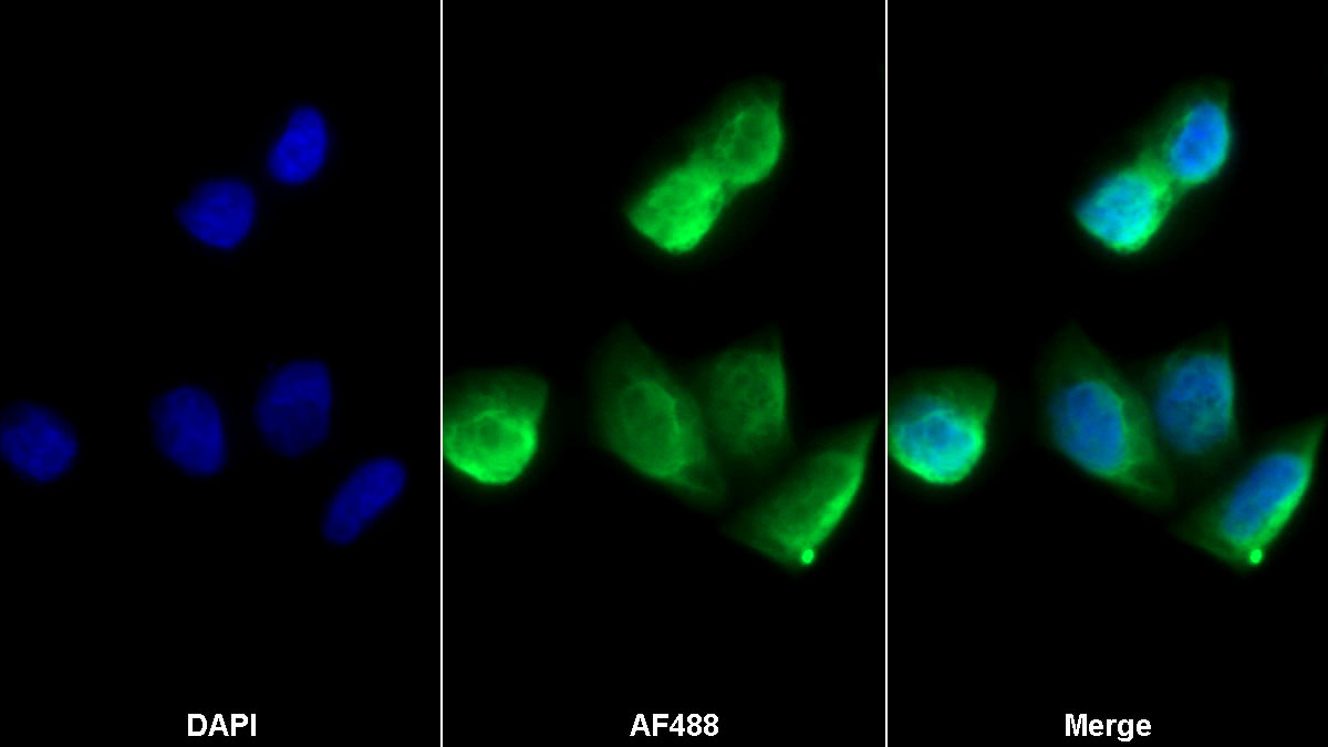 Monoclonal Antibody to Vascular Endothelial Growth Factor 121 (VEGF121)