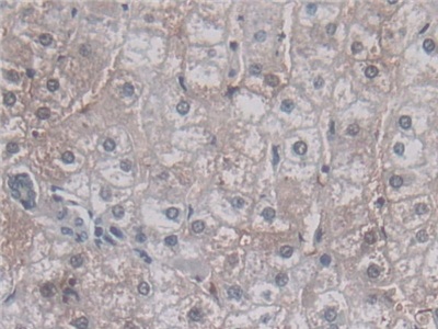 Monoclonal Antibody to Vascular Endothelial Growth Factor 121 (VEGF121)