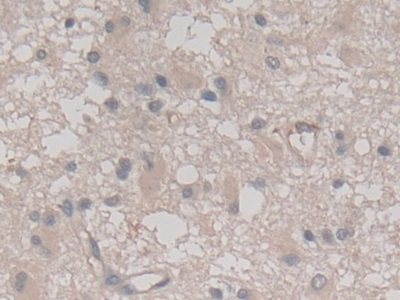 Monoclonal Antibody to Vascular Endothelial Growth Factor 121 (VEGF121)