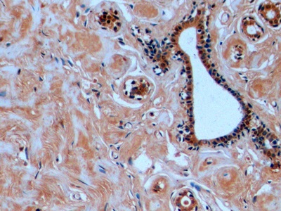 Monoclonal Antibody to Tubulin Beta (TUBb)