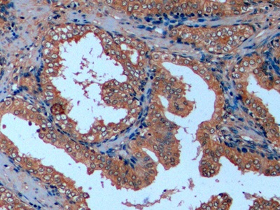 Monoclonal Antibody to Tubulin Beta (TUBb)