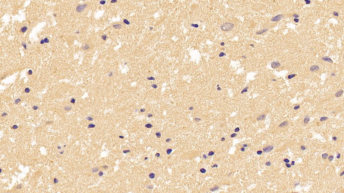 Monoclonal Antibody to Tubulin Beta (TUBb)