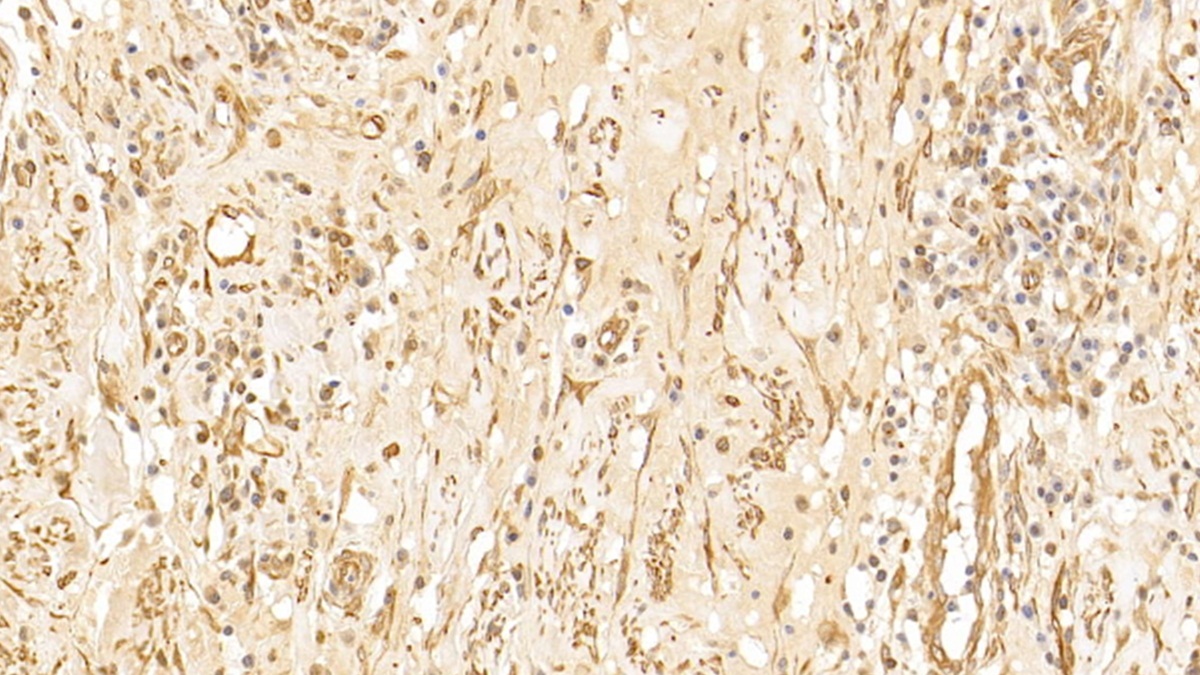 Monoclonal Antibody to Tubulin Beta (TUBb)