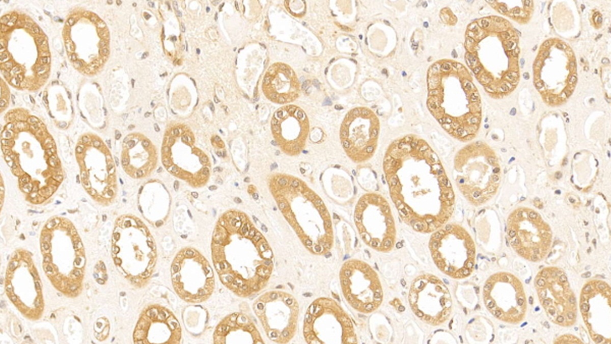 Monoclonal Antibody to Tubulin Beta (TUBb)