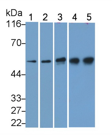 Monoclonal Antibody to Tubulin Beta (TUBb)