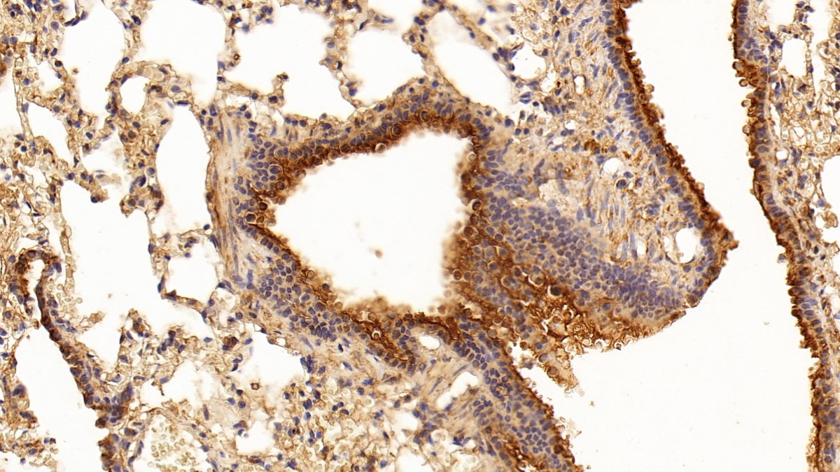 Monoclonal Antibody to Tubulin Beta (TUBb)