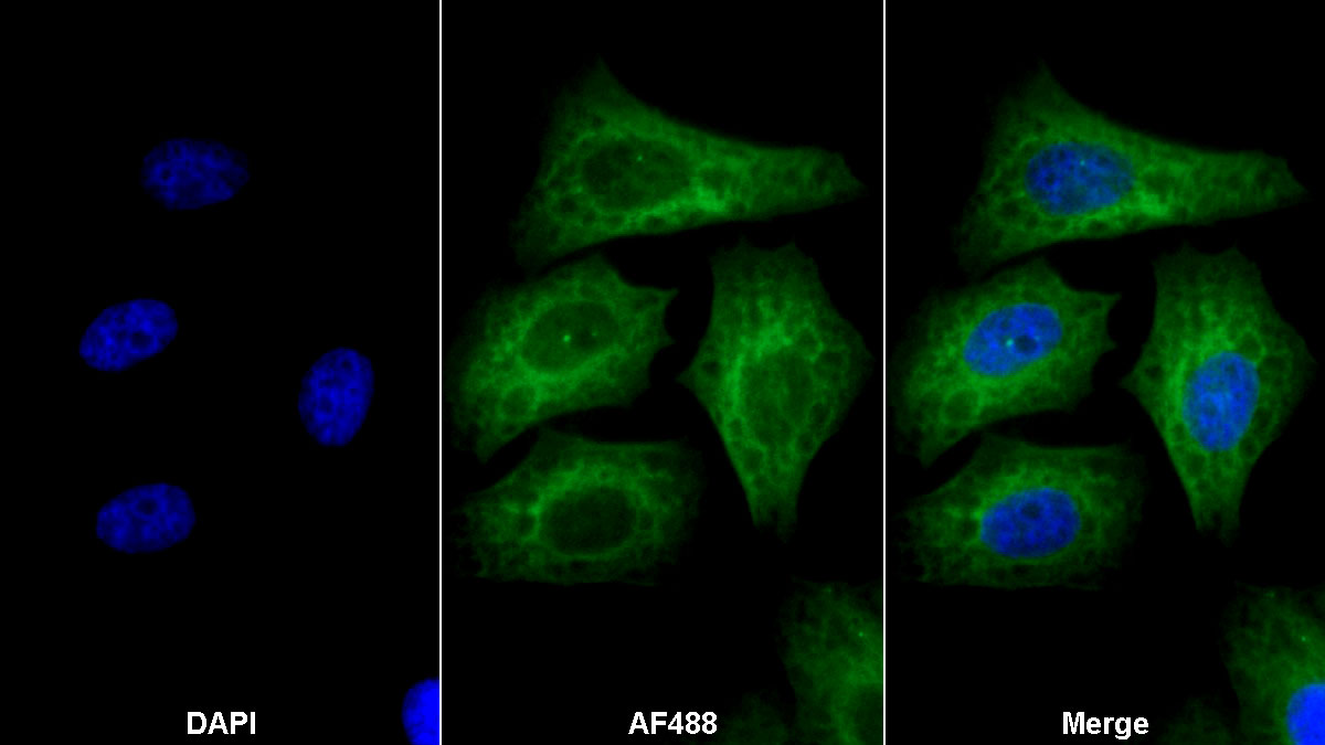 Monoclonal Antibody to Tubulin Beta (TUBb)