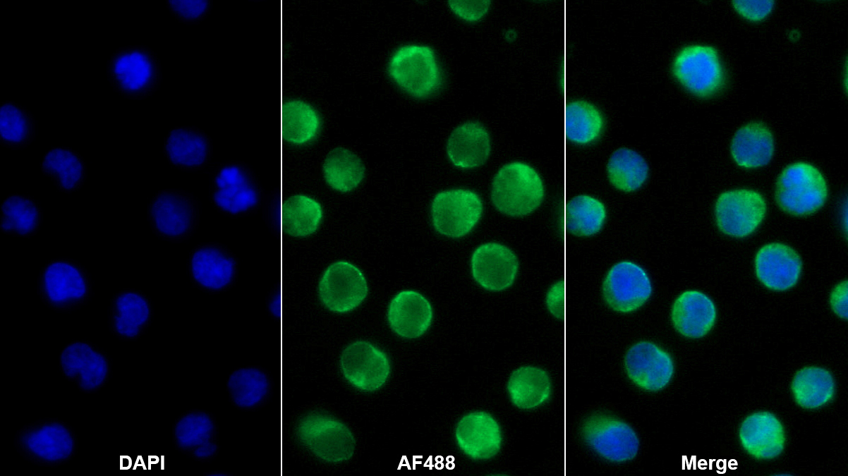 Monoclonal Antibody to Cluster Of Differentiation 19 (CD19)