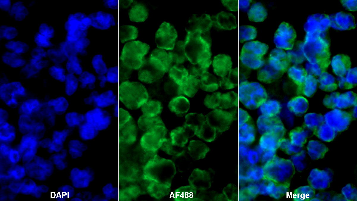 Monoclonal Antibody to Cluster Of Differentiation 19 (CD19)