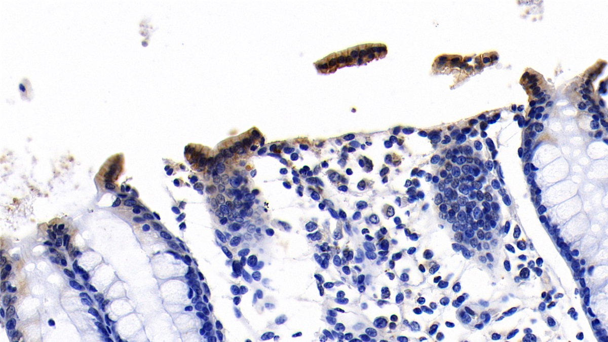 Monoclonal Antibody to Angiotensin I Converting Enzyme 2 (ACE2)