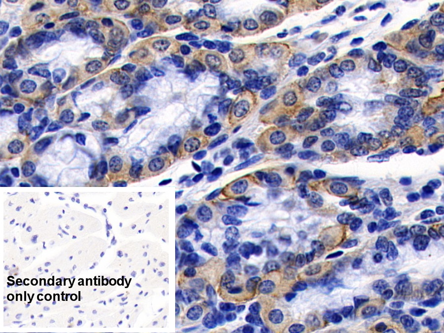 Monoclonal Antibody to Angiotensin I Converting Enzyme 2 (ACE2)