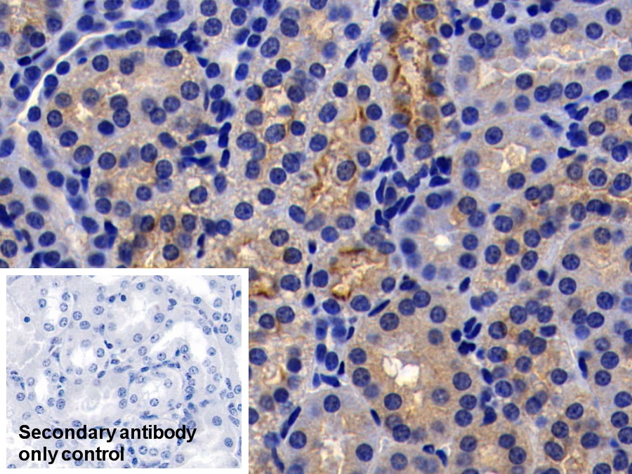 Monoclonal Antibody to Angiotensin I Converting Enzyme 2 (ACE2)