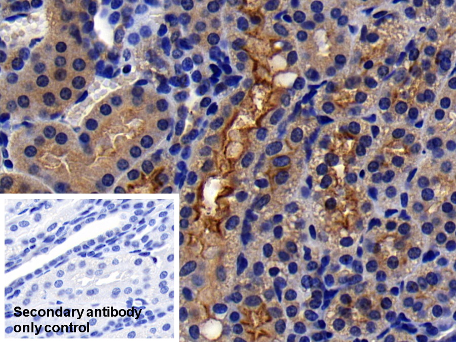 Monoclonal Antibody to Angiotensin I Converting Enzyme 2 (ACE2)