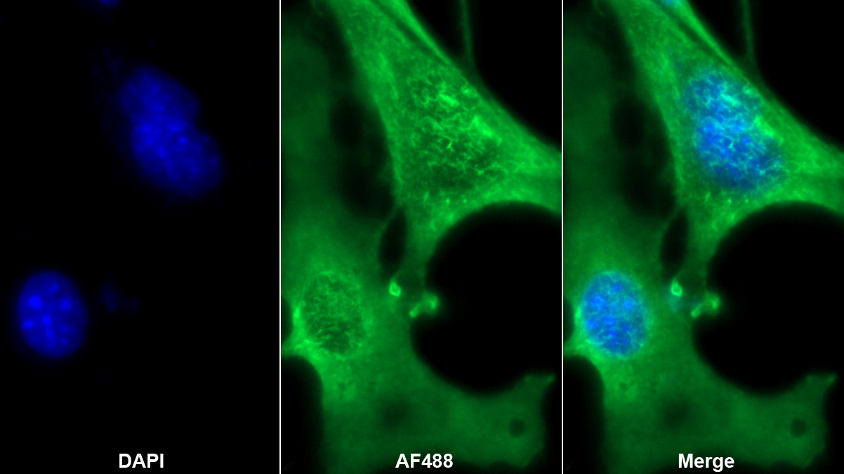 Monoclonal Antibody to Angiotensin I Converting Enzyme 2 (ACE2)