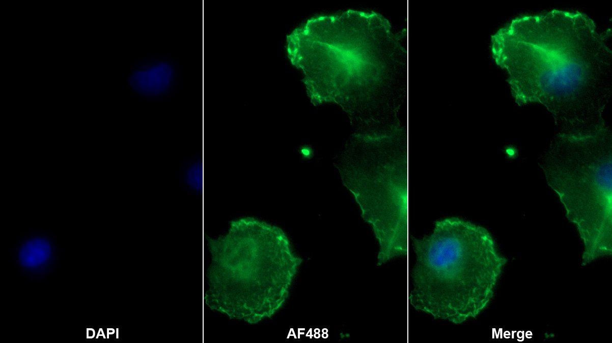 Monoclonal Antibody to Insulin Degrading Enzyme (IDE)