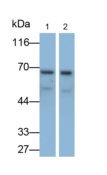 Monoclonal Antibody to Interleukin 7 Receptor (IL7R)