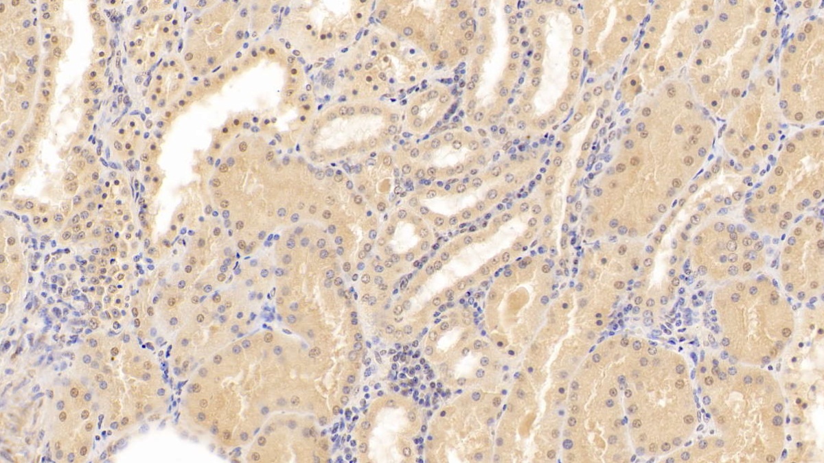 Monoclonal Antibody to Monokine Induced By Interferon Gamma (MIg)