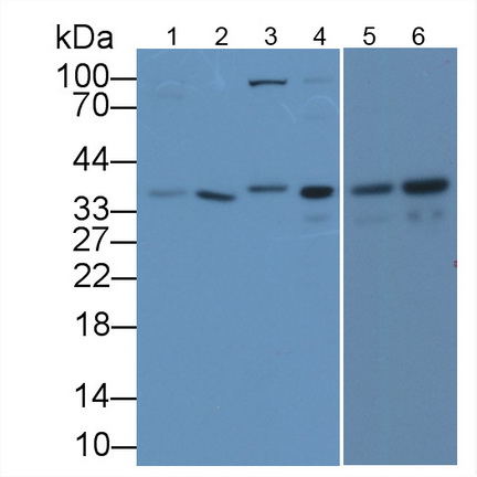 Monoclonal Antibody to Glyceraldehyde-3-Phosphate Dehydrogenase (GAPDH)