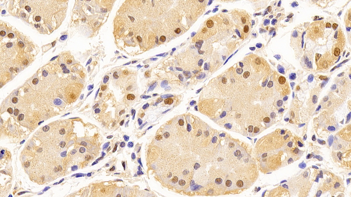 Monoclonal Antibody to Glyceraldehyde-3-Phosphate Dehydrogenase (GAPDH)