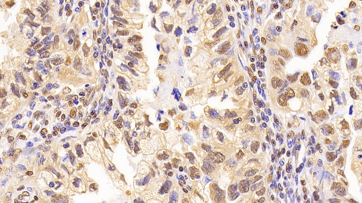 Monoclonal Antibody to Glyceraldehyde-3-Phosphate Dehydrogenase (GAPDH)