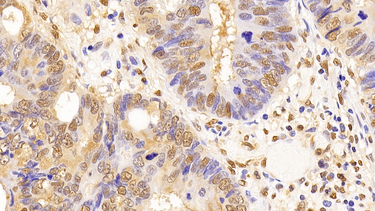 Monoclonal Antibody to Glyceraldehyde-3-Phosphate Dehydrogenase (GAPDH)