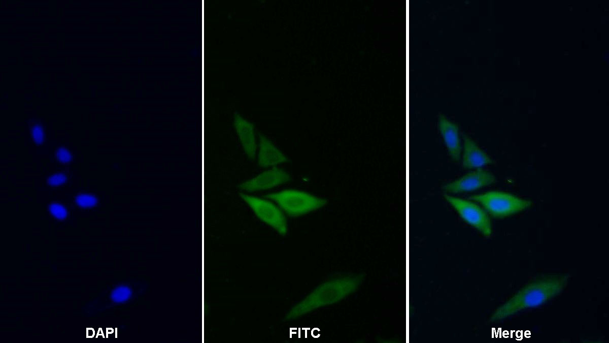 Monoclonal Antibody to Glyceraldehyde-3-Phosphate Dehydrogenase (GAPDH)