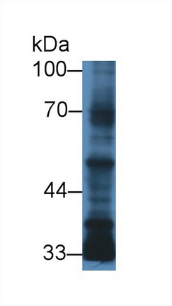 Monoclonal Antibody to Transforming Growth Factor Beta 3 (TGFb3)