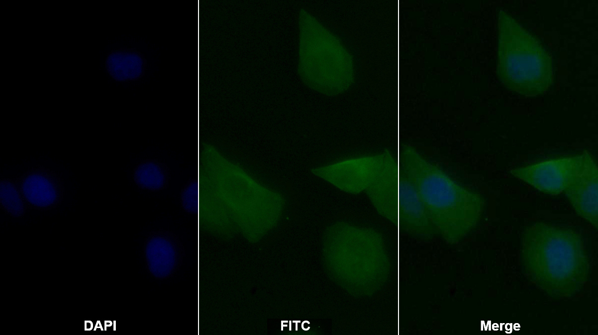 Monoclonal Antibody to Transforming Growth Factor Beta 3 (TGFb3)