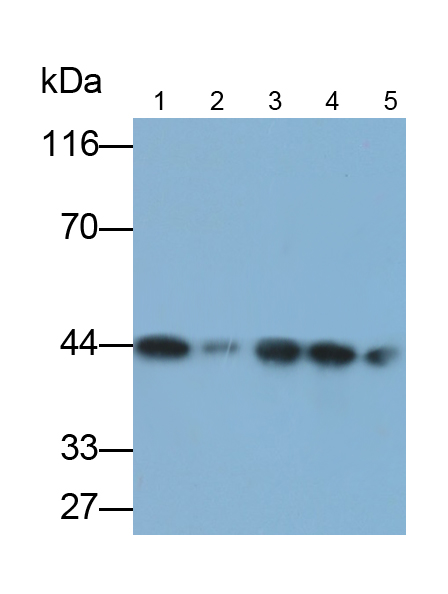 Monoclonal Antibody to Tar DNA Binding Protein 43kDa (TDP43)