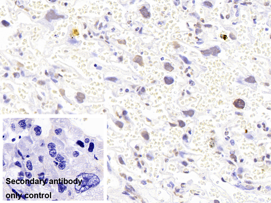 Monoclonal Antibody to Tar DNA Binding Protein 43kDa (TDP43)