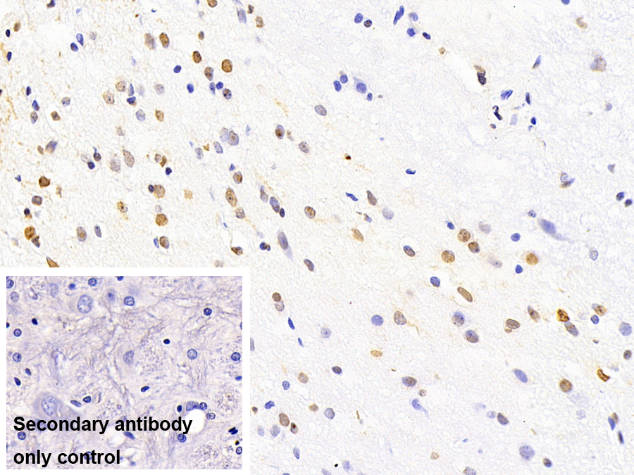 Monoclonal Antibody to Tar DNA Binding Protein 43kDa (TDP43)
