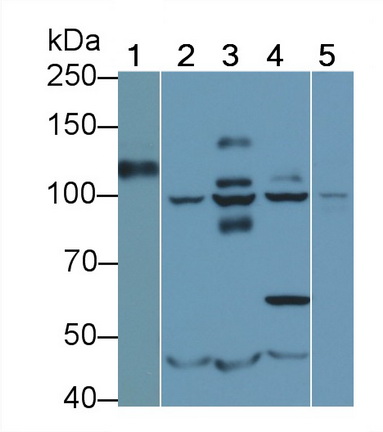 Monoclonal Antibody to Cluster Of Differentiation 34 (CD34)