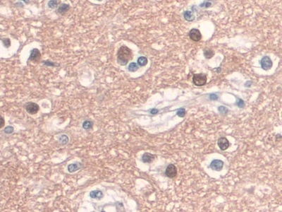 Monoclonal Antibody to Cluster Of Differentiation 34 (CD34)