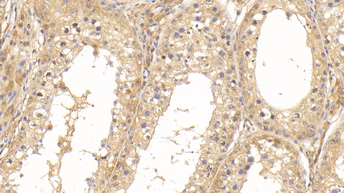 Monoclonal Antibody to Superoxide Dismutase 1 (SOD1)