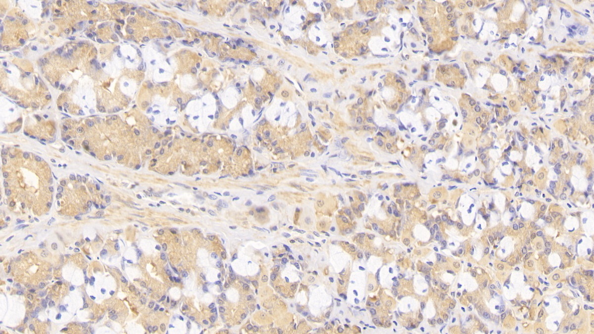 Monoclonal Antibody to Tenascin C (TNC)