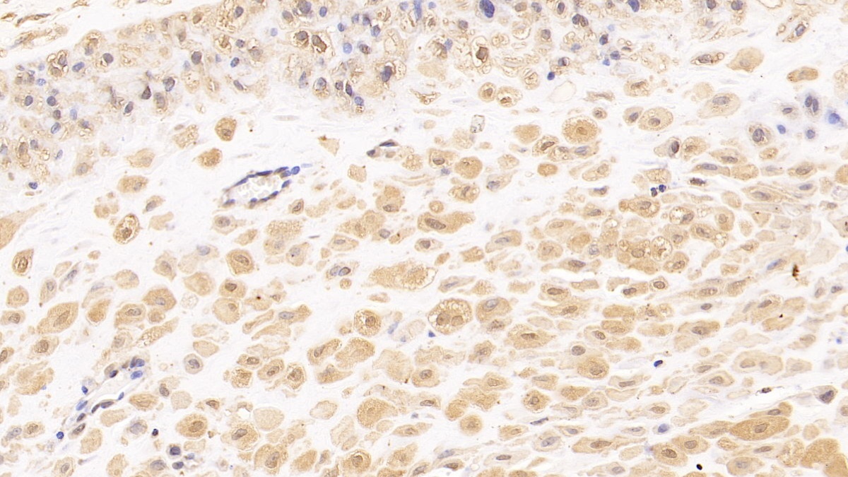 Monoclonal Antibody to Tenascin C (TNC)