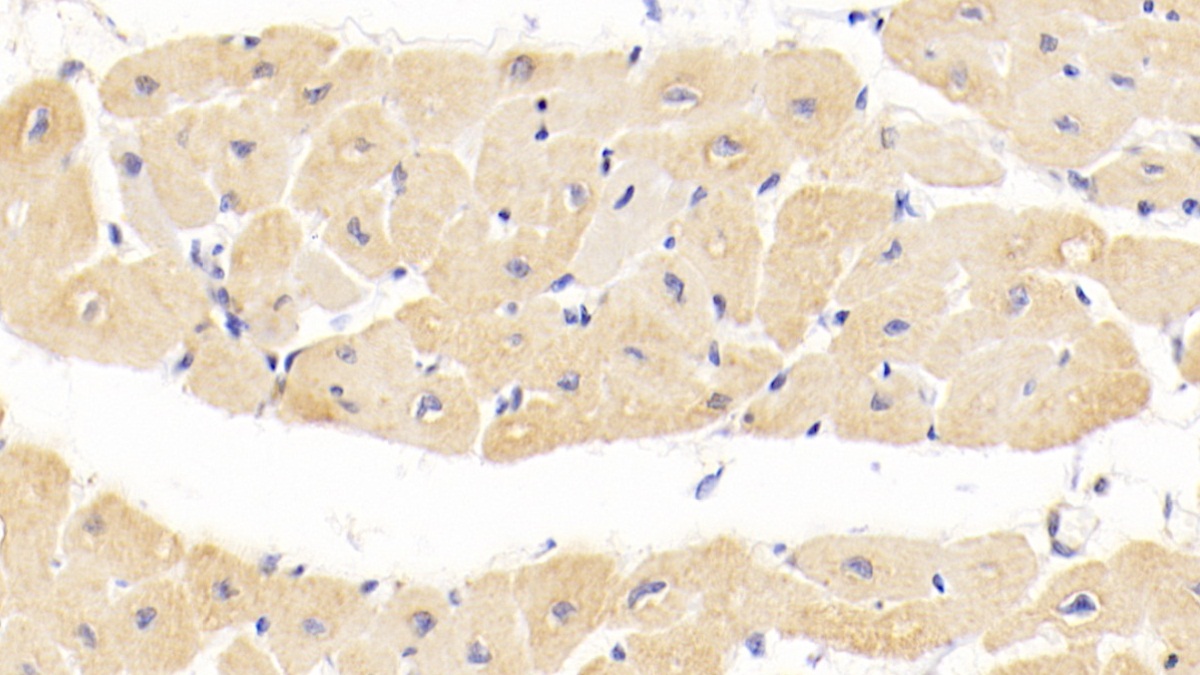 Monoclonal Antibody to Tenascin C (TNC)