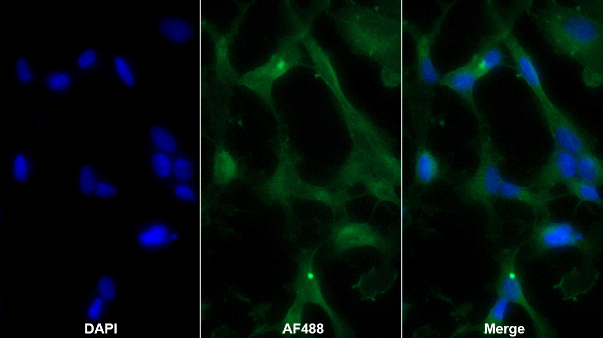 Monoclonal Antibody to Tau-Protein Kinase 1 (tPK1)