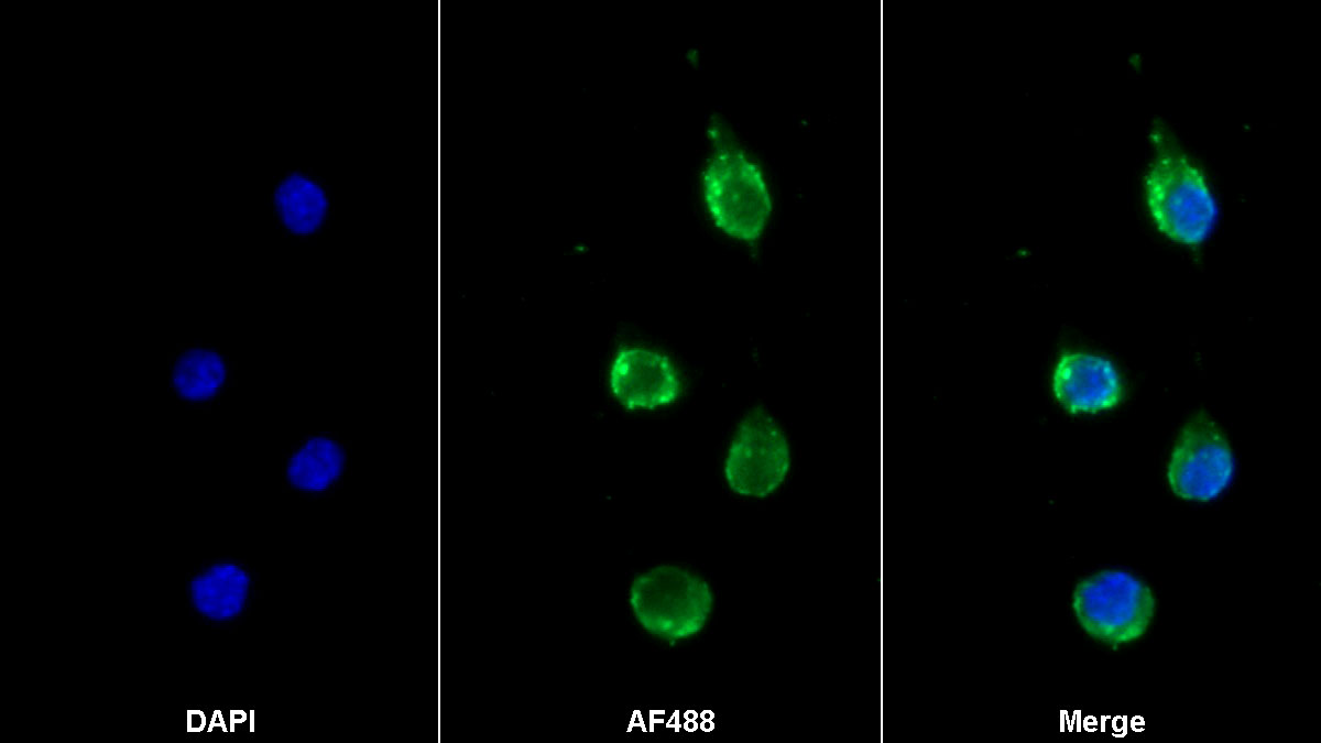 Monoclonal Antibody to Toll Like Receptor 1 (TLR1)