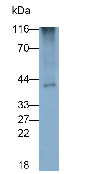 Monoclonal Antibody to Hemojuvelin (HJV)