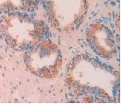 Monoclonal Antibody to Apolipoprotein A5 (APOA5)