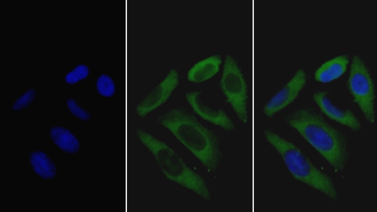 Monoclonal Antibody to Haptoglobin Related Protein (HPR)