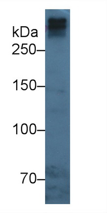 Monoclonal Antibody to Apolipoprotein B (APOB)