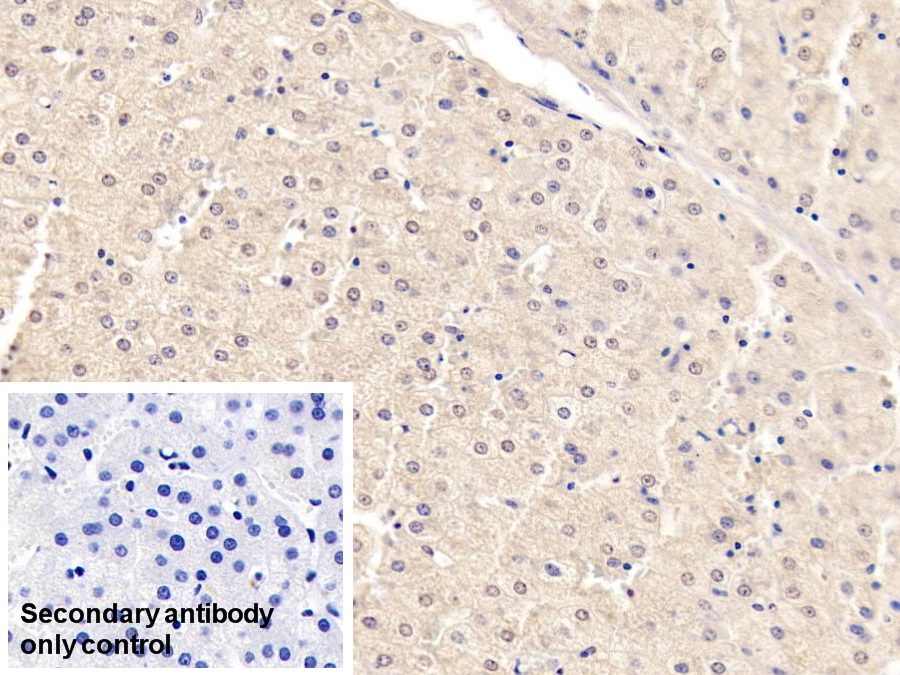 Monoclonal Antibody to Apolipoprotein B (APOB)