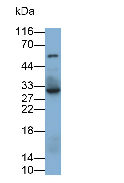 Monoclonal Antibody to Interleukin 35 (IL35)