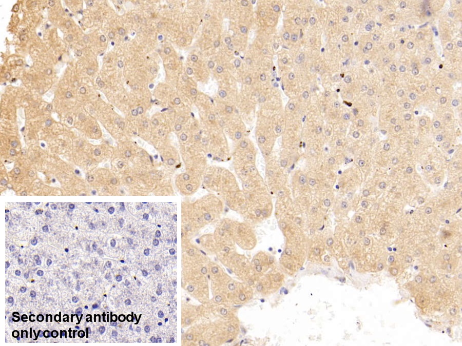 Monoclonal Antibody to Serpin A10 (SERPINA10)