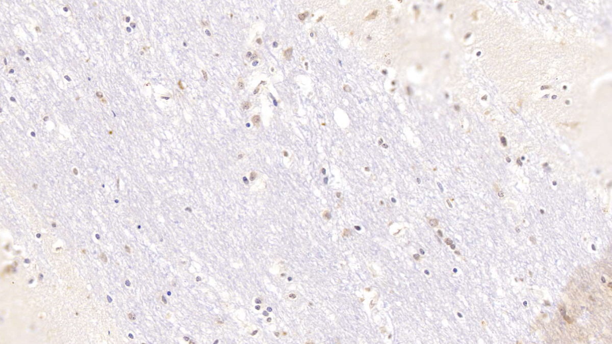 Monoclonal Antibody to Serpin A10 (SERPINA10)