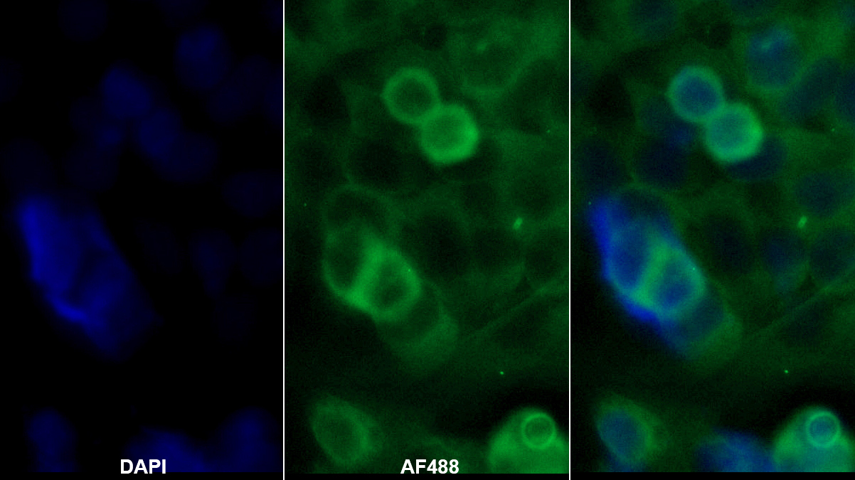 Monoclonal Antibody to Serpin A10 (SERPINA10)